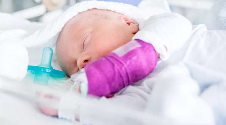 Baby auf der Neonatologie mit lilafarbenem Gips und grünem Schnuller