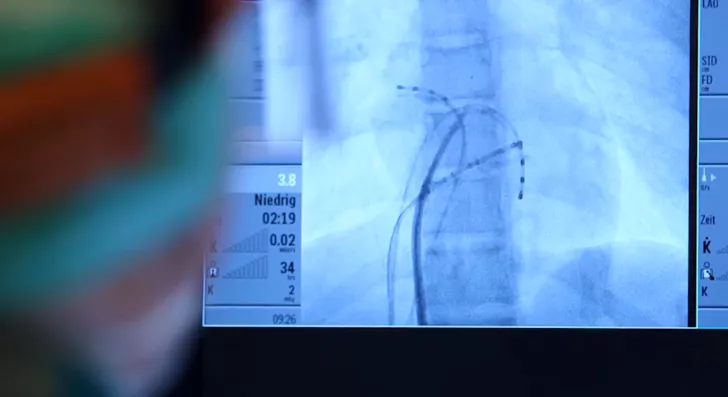 Ein Röntgenbild, auf welchem Drähte im Körper zu sehen sind.